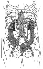 Retroperitoneal zones.jpg