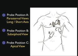 Cardiac Ultrasound.png