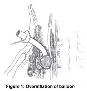 Hyperinflation-leveraging against innominate.jpg