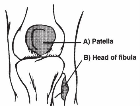 Ottawa-Knee.jpg