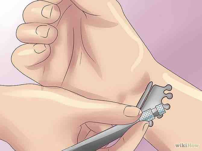 Imagen titulada Remove a Tattoo at Home With Salt Step 6