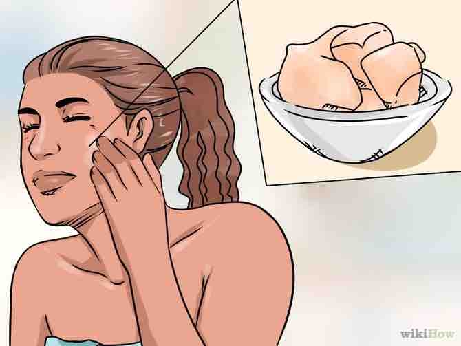 Imagen titulada Get Rid of Scars Completely Step 5