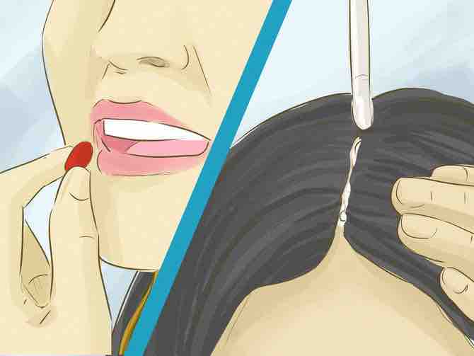 prevenir la caída del cabello