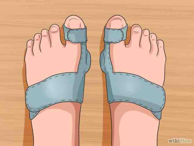 Imagen titulada Get Rid of Bunions Step 8