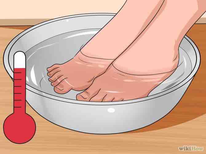 Imagen titulada Get Rid of Bunions Step 7