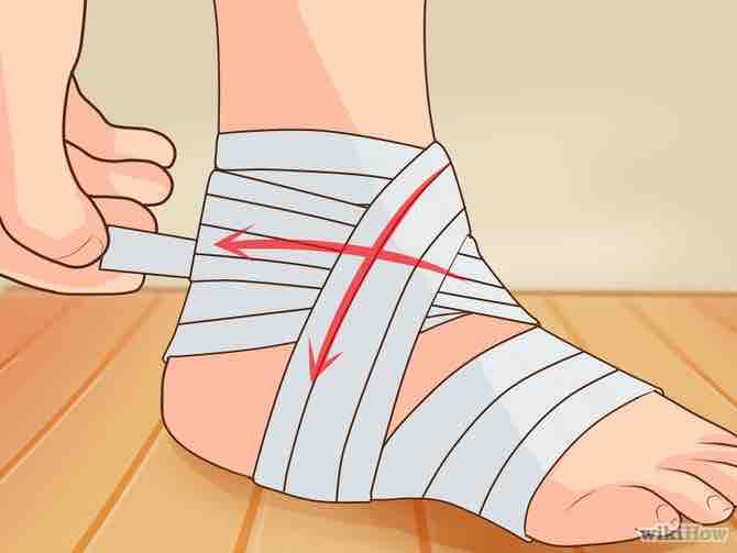 Imagen titulada Wrap an Ankle Step 10