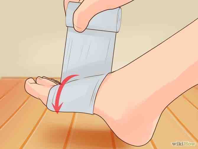 Imagen titulada Wrap an Ankle Step 2