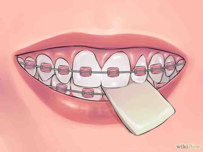 Imagen titulada Deal with Braces Step 6