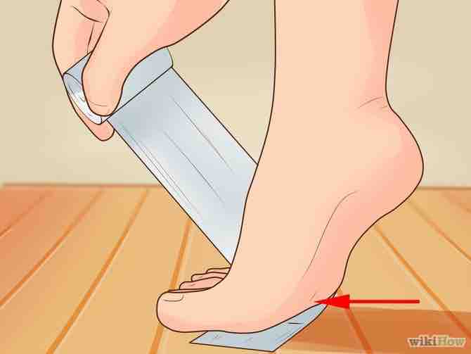 Imagen titulada Wrap an Ankle Step 1