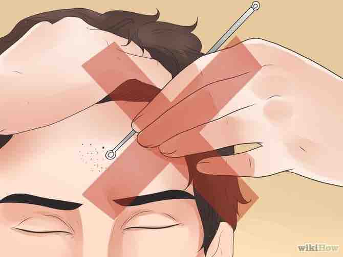 Imagen titulada Remove Blackheads Step 20