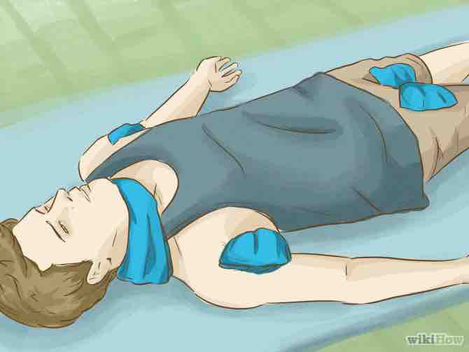 Imagen titulada Get Rid of Sunstroke Step 3