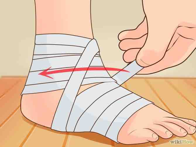 Imagen titulada Wrap an Ankle Step 9