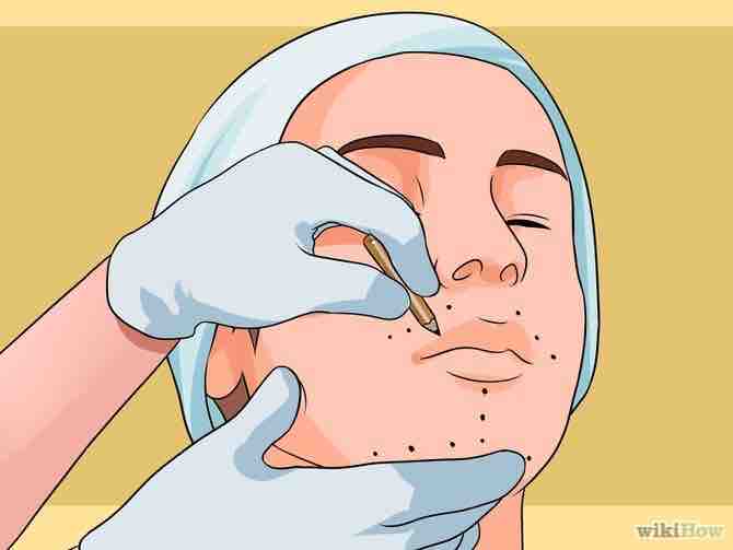 hacer crecer el vello facial