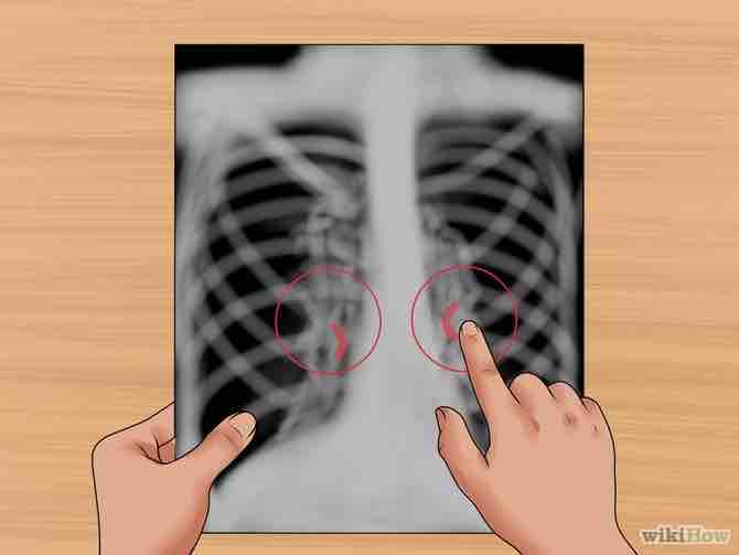 interpretar una radiografía de tórax