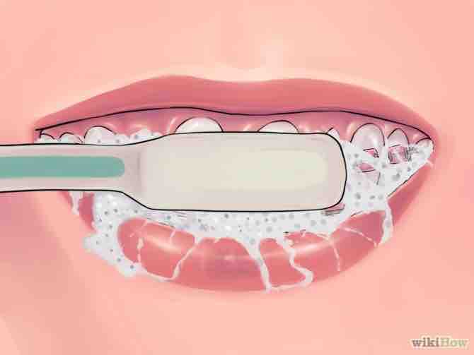 Imagen titulada Deal with Braces Step 8