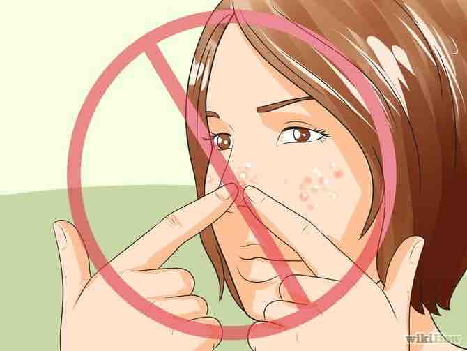 Imagen titulada Get Rid of Pimples Naturally (Sea Salt Method) Step 35