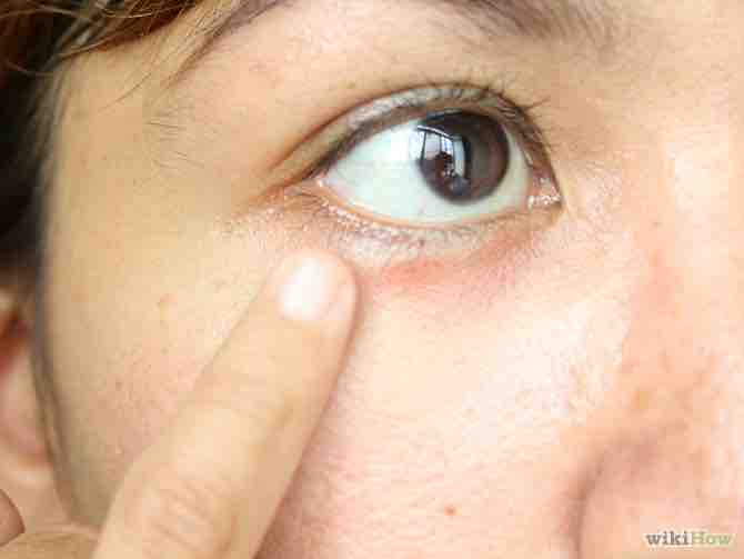 Imagen titulada Conceal Dark Circles Under the Eyes Step 3