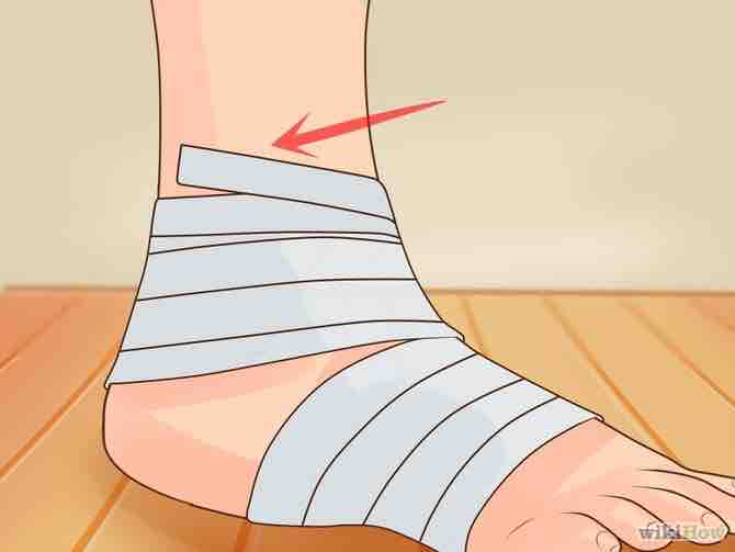 Imagen titulada Wrap an Ankle Step 8