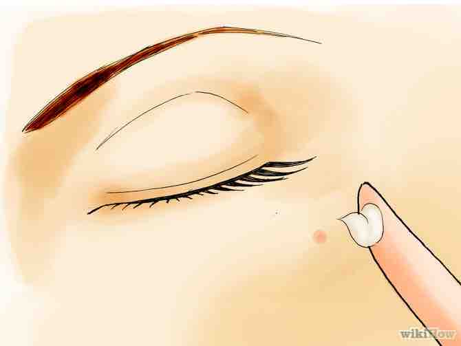 Imagen titulada Remove Facial Warts Step 07