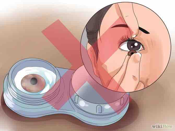 Imagen titulada Care for Pink Eye Step 5